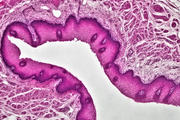 Rough Endoplasmic Reticulum (RER):